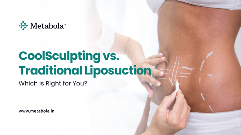 CoolSculpting vs. Traditional Liposuction: Which Is Right for You?